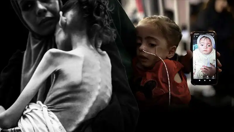 Küçük Meryem’in Dramı: 25 Kilodan 10 Kiloya Düşüşü Açlıkla Mücadelenin Hikayesi