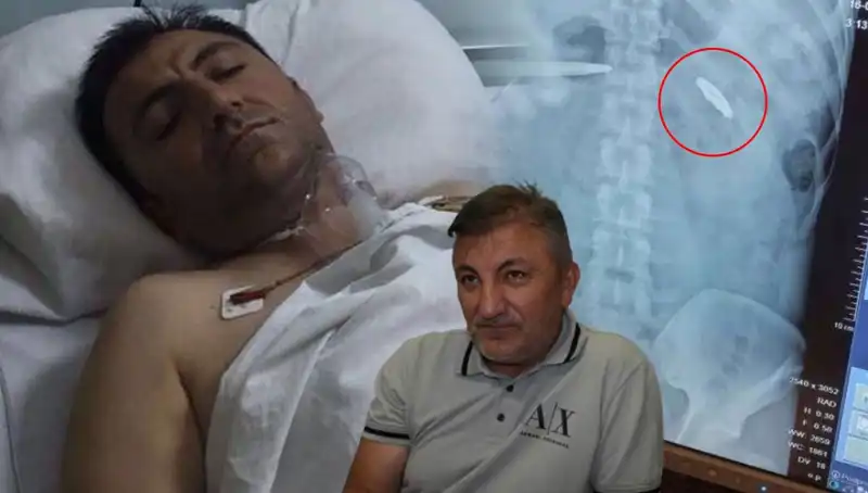 15 Temmuz’un Acı Yüzü: Kurşunla Yaralananların Hikayeleri
